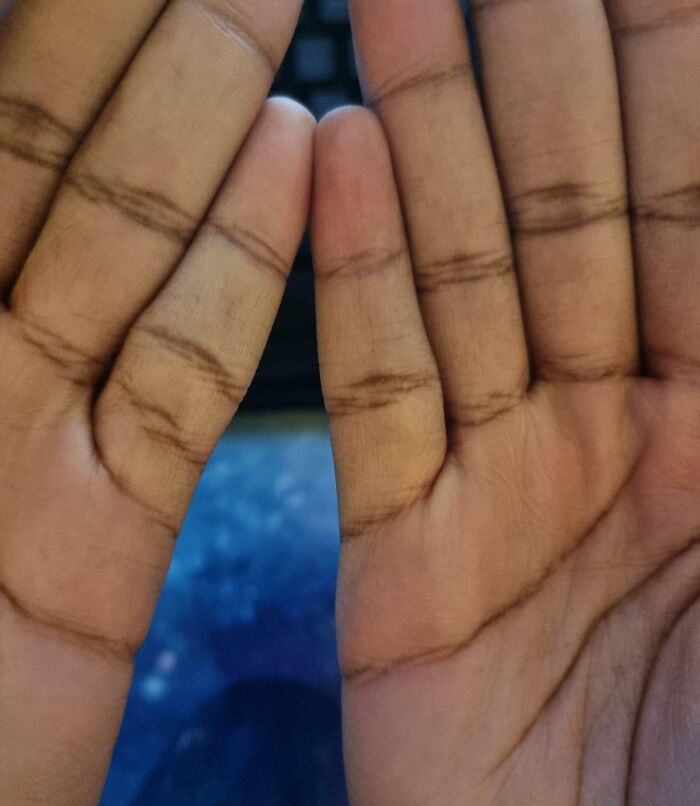 I Have An Extra Crease On My Left Pinky