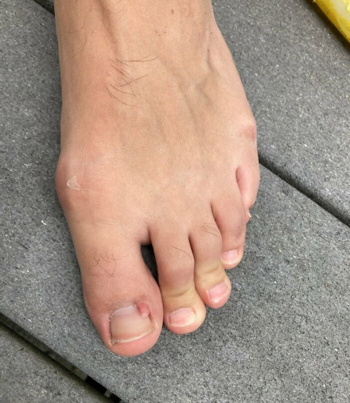 This Toe, With It's Own Toe, Complete With It's Own Nail