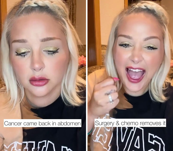 Woman Was Diagnosed With Cervical Cancer 3 Times And Shares The Hard And Joyous Days She Has On TikTok