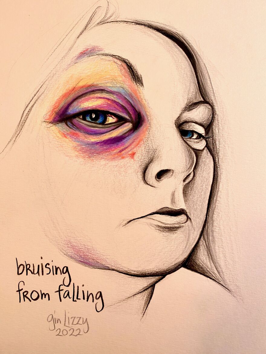 I Drew A Series Of Portraits Of My Friends' Self-Documented Injuries & Medical Issues