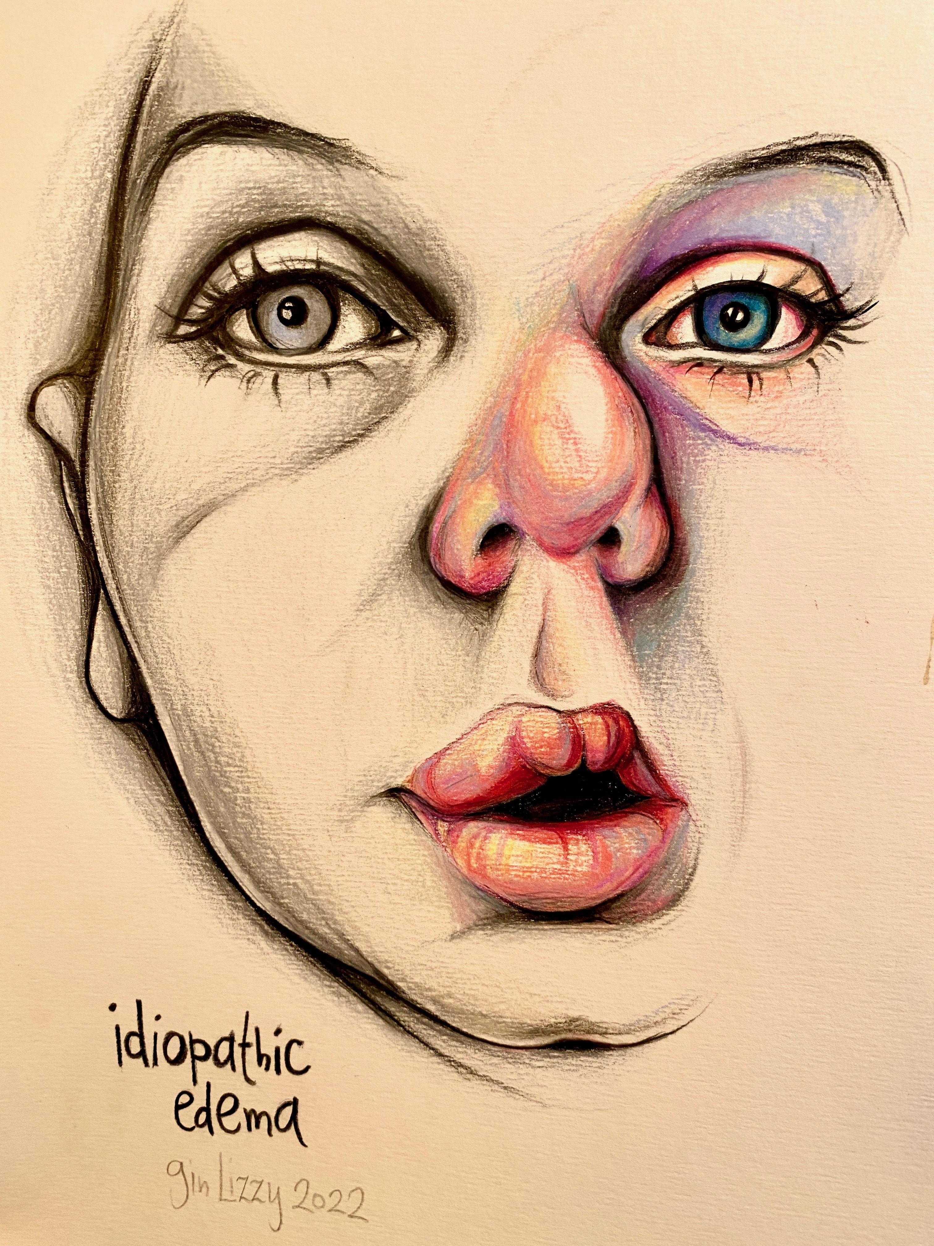 I Drew A Series Of Portraits Of My Friends’ Self-Documented Injuries & Medical Issues