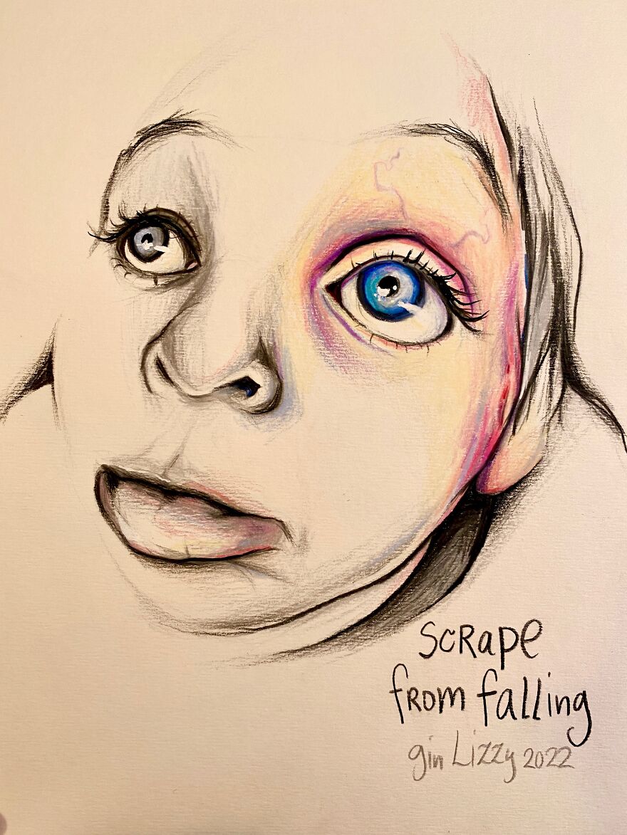 I Drew A Series Of Portraits Of My Friends' Self-Documented Injuries & Medical Issues