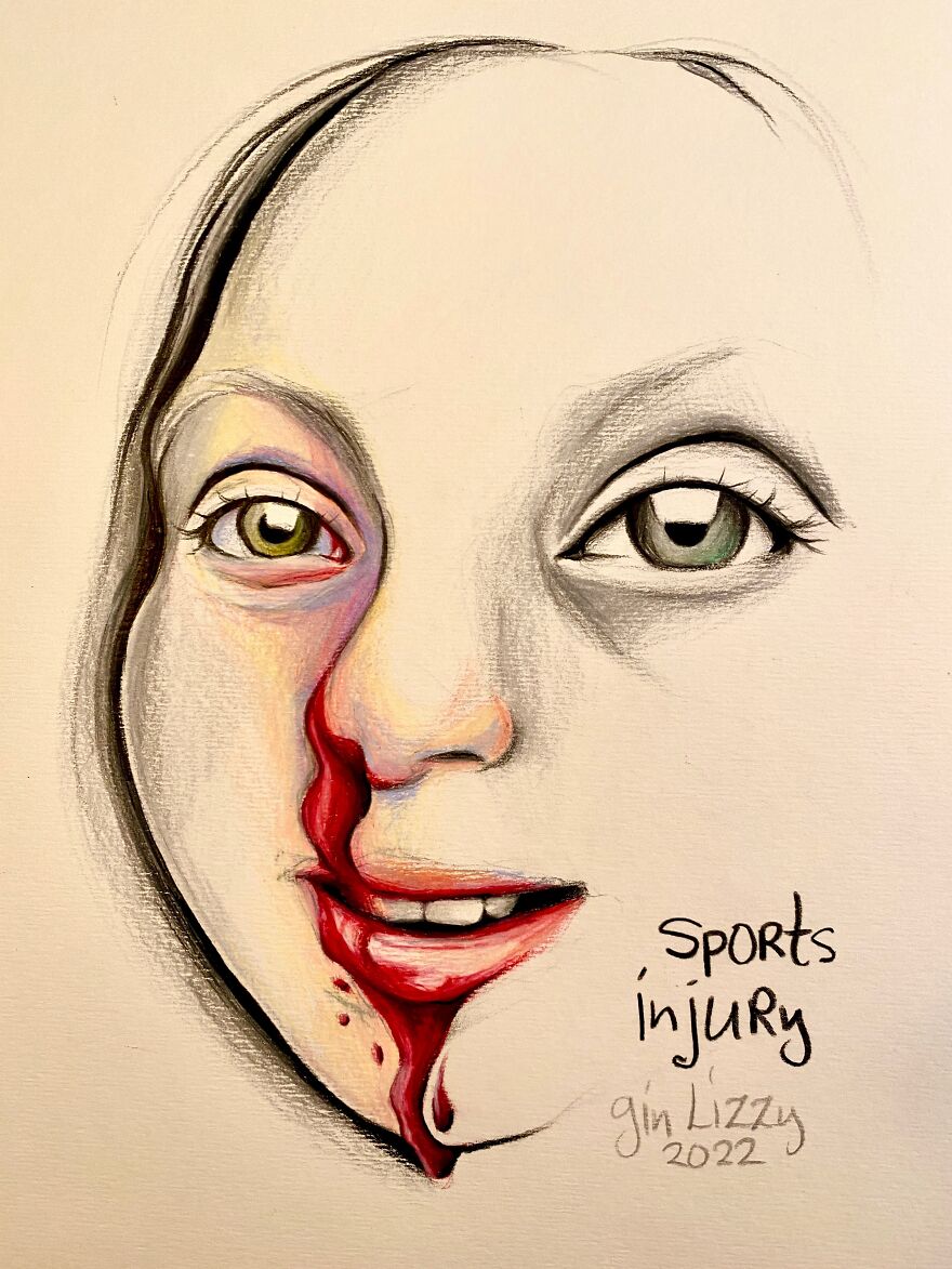 I Drew A Series Of Portraits Of My Friends' Self-Documented Injuries & Medical Issues