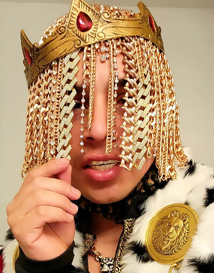 Dan Sur Replaces Hair With Surgically Implanted Gold Chains