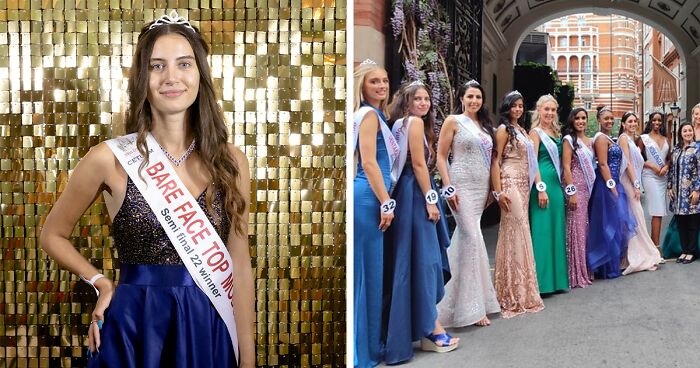 Miss England Finalist Competes Makeup-Free, Stirs Up Debate On Beauty Standards Online