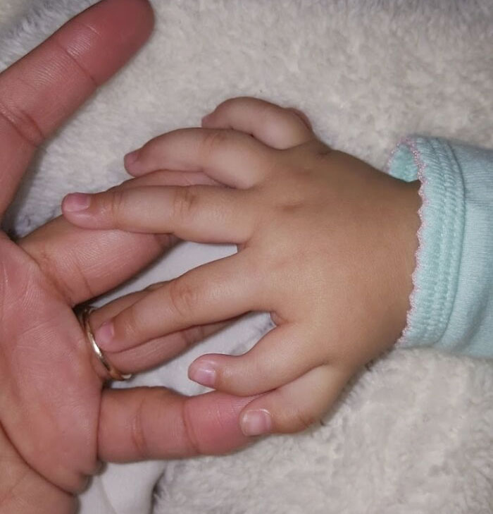 My Little Sister Was Born With Six Fingers