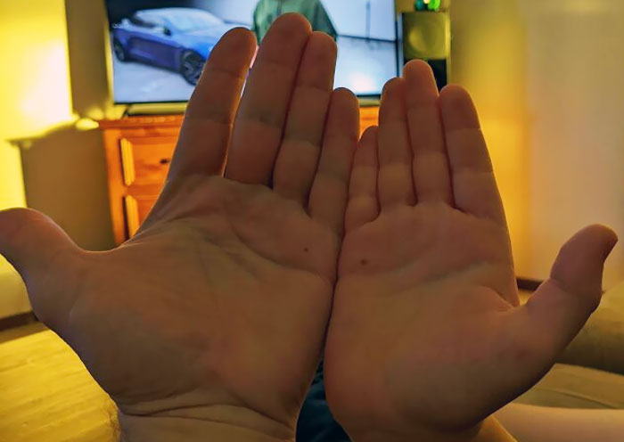 My Son And I Have A Freckle On The Same Part Of Our Hands. Mine On The Left, His On The Right