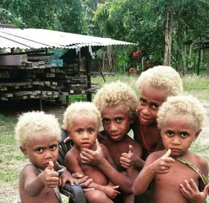 Melanasian Tribe Have Naturally Blond Hair