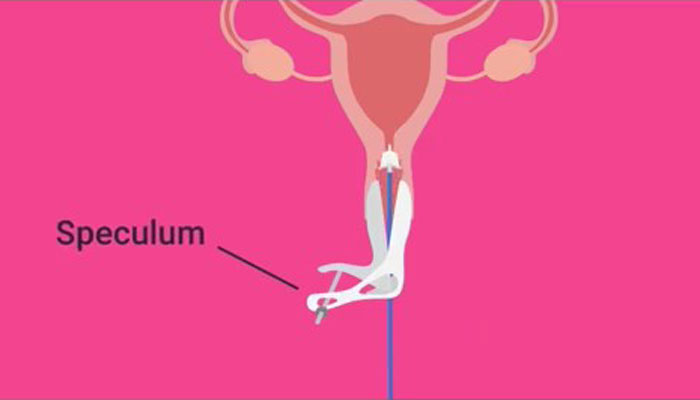 Woman Was Diagnosed With Cervical Cancer 3 Times And Shares The Hard And Joyous Days She Has On TikTok Woman Was Diagnosed With Cervical Cancer 3 Times And Shares The Hard And Joyous Days She Has On TikTok