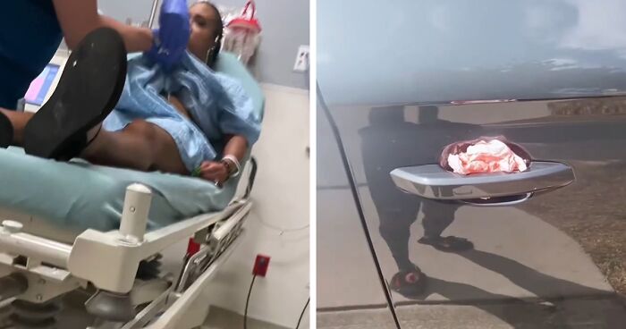Woman Says She Ended Up In The Hospital Because She Removed A Napkin From Her Car, Creates A Video To Warn Others