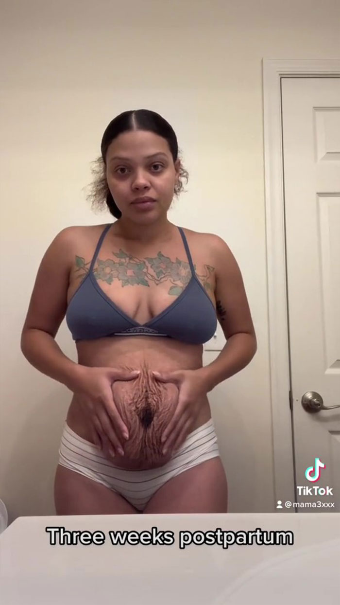 TikTok Mom Exposes Her Postpartum Journey To Combat Unrealistic Depictions Of Post-Pregnancy Bodies TikTok Mom Exposes Her Postpartum Journey To Combat Unrealistic Depictions Of Post-Pregnancy Bodies