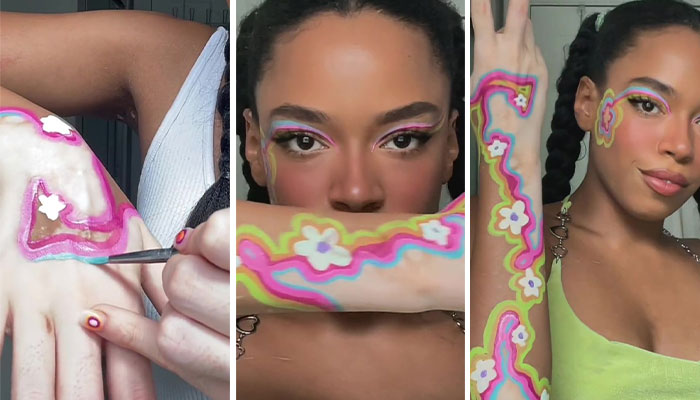 Woman Matches The Color Of The Paint She Outlines Her Vitiligo Spots With To Her Outfits, And People Can’t Get Enough