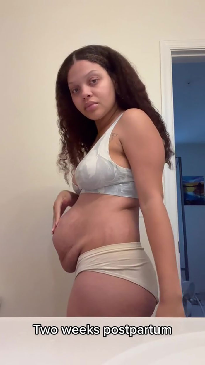 TikTok Mom Exposes Her Postpartum Journey To Combat Unrealistic Depictions Of Post-Pregnancy Bodies