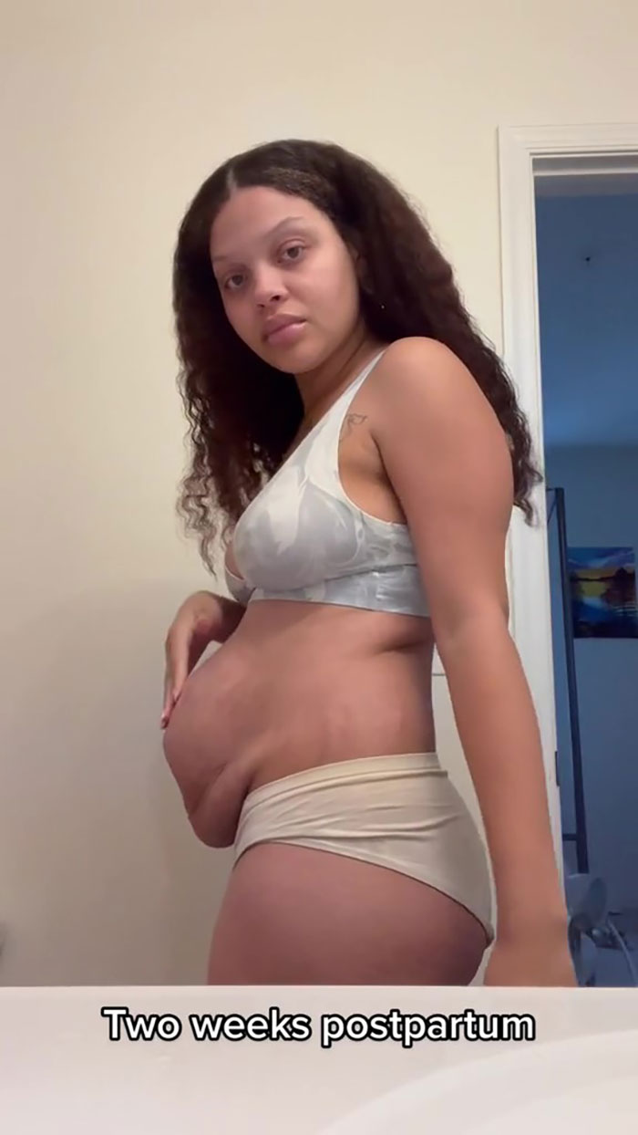 TikTok Mom Exposes Her Postpartum Journey To Combat Unrealistic Depictions Of Post-Pregnancy Bodies TikTok Mom Exposes Her Postpartum Journey To Combat Unrealistic Depictions Of Post-Pregnancy Bodies