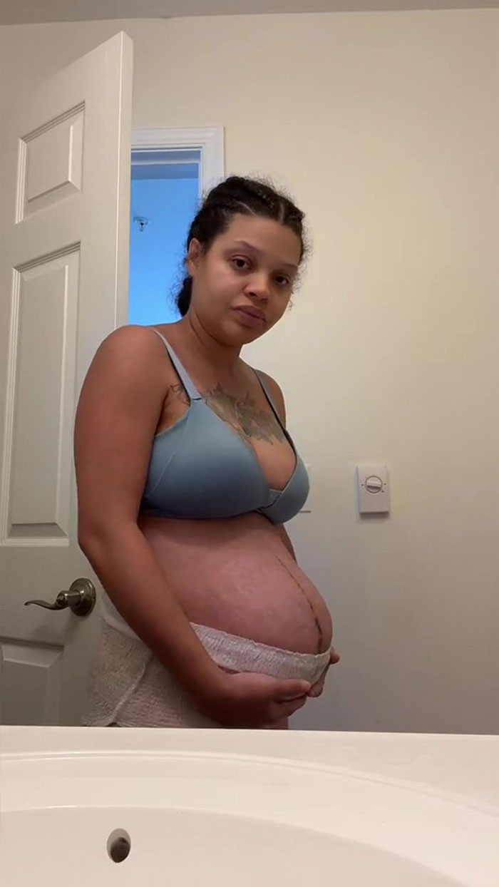 TikTok Mom Exposes Her Postpartum Journey To Combat Unrealistic Depictions Of Post-Pregnancy Bodies