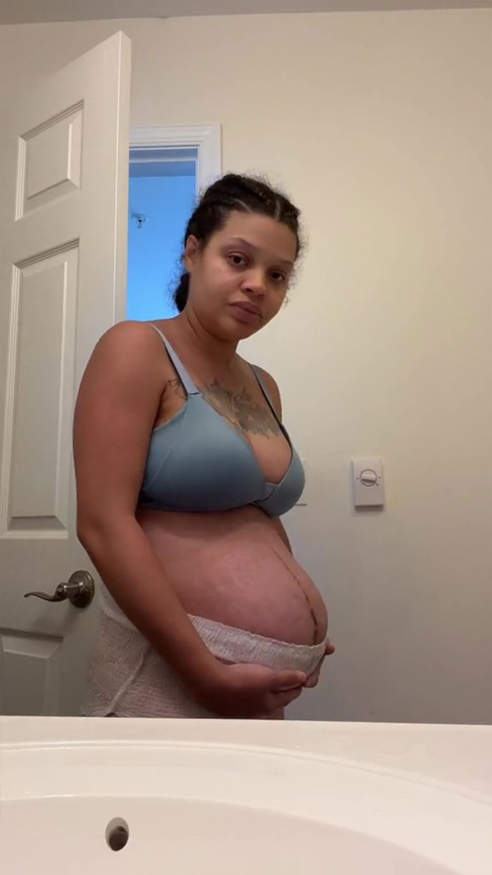 TikTok Mom Exposes Her Postpartum Journey To Combat Unrealistic Depictions Of Post-Pregnancy Bodies TikTok Mom Exposes Her Postpartum Journey To Combat Unrealistic Depictions Of Post-Pregnancy Bodies