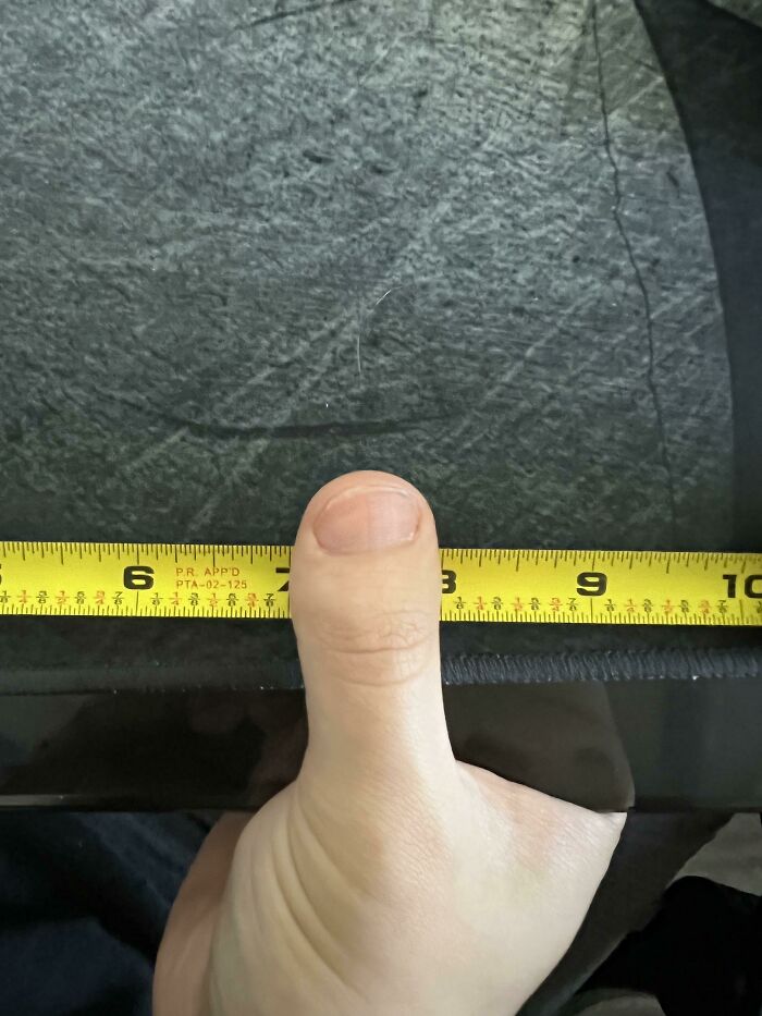 My Thumb Looks Like A Toe And Is Exactly 1 Inch Wide