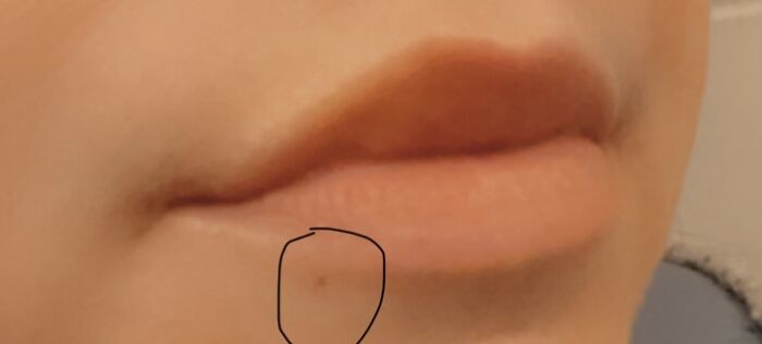 I Pierced My Own Lip When I Was 15 - Basically Looks Like A Big Hole When I Purse My Lips