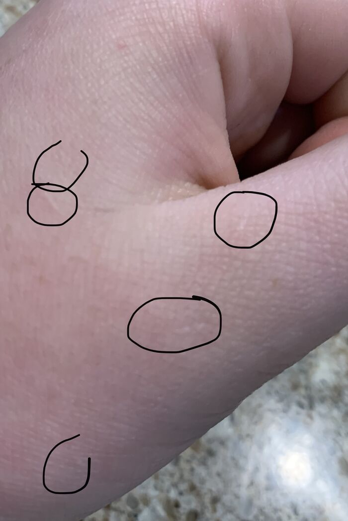 I Fell Out Of A Tree Trying To Grab A Cool Leaf When I Was 5