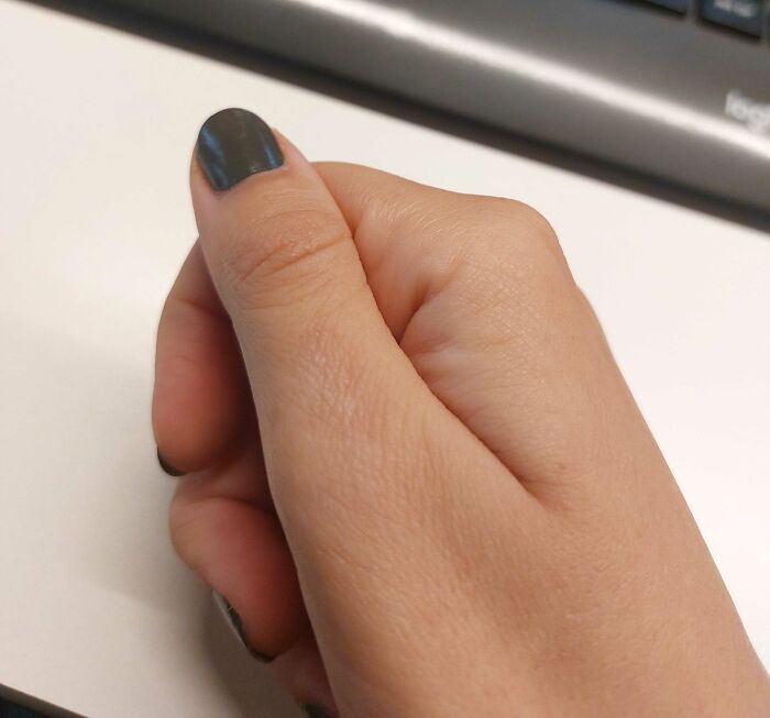 Not That Visible But There's A Scar On My Thumb I Got When I Spilled Hot Caramel While Making A Ginger House