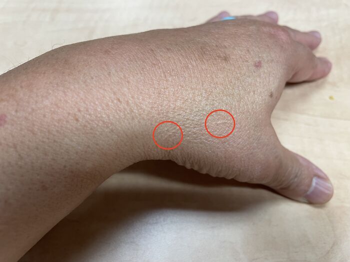 I Told F.c. That I Did Not Like Her, She Grabbed My Hand With Her Fingernails And Screamed, "I Hate You Forever!"