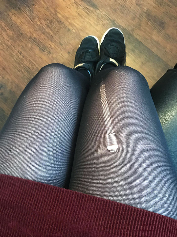 I Pulled My Tights Up, And My Finger Went Straight Through
