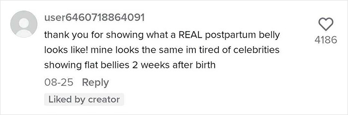 TikTok Mom Exposes Her Postpartum Journey To Combat Unrealistic Depictions Of Post-Pregnancy Bodies TikTok Mom Exposes Her Postpartum Journey To Combat Unrealistic Depictions Of Post-Pregnancy Bodies