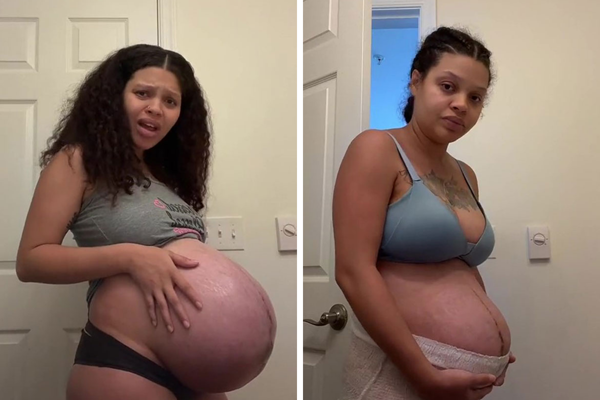 TikTok Mom Exposes Her Postpartum Journey To Combat Unrealistic Depictions  Of Post-Pregnancy Bodies