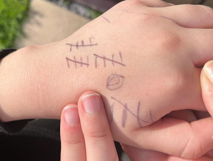 Father Is Upset As His Son Comes Home From School With Marks On His Hand Recording Times He Was Bullied Over 2 Days