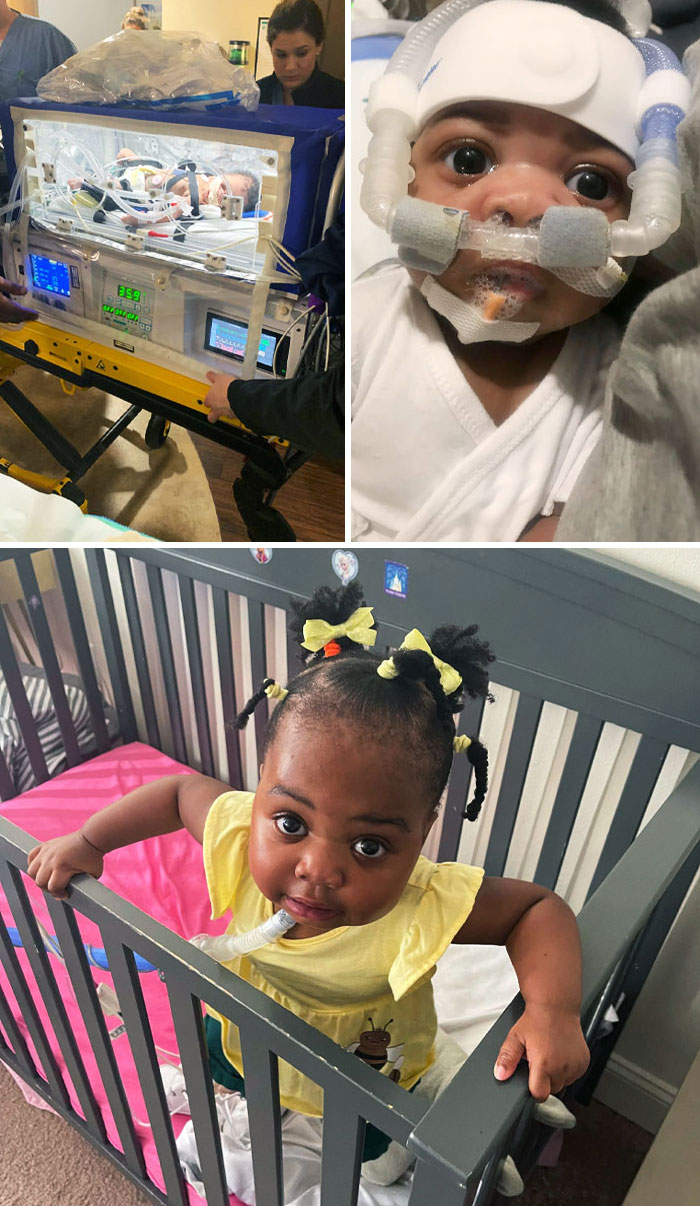 Mi hija nació con una terrible enfermedad pulmonar y estuvo con soporte vital durante sus primeros cuatro días en la Tierra. Antes y después