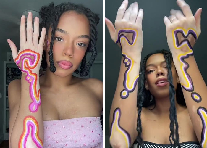 Woman Matches The Color Of The Paint She Outlines Her Vitiligo Spots With To Her Outfits, And People Can’t Get Enough