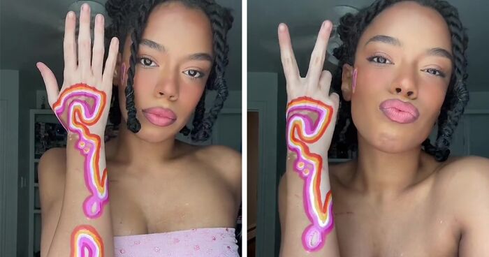 Woman Matches The Color Of The Paint She Outlines Her Vitiligo Spots With To Her Outfits, And People Can’t Get Enough