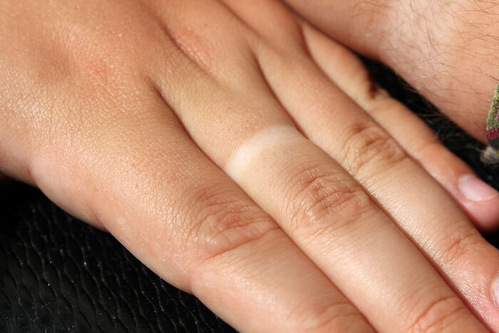 “What's Something That's Considered Normal That Creeps You Out Immediately?” (40 Answers)