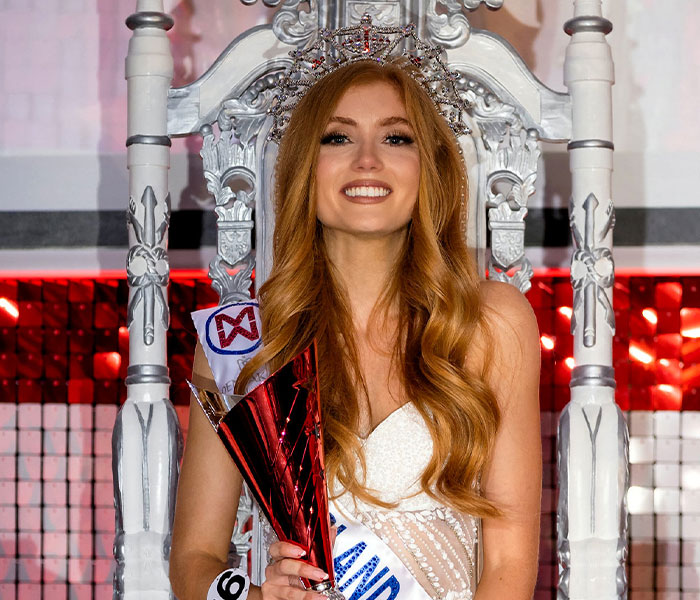 Woman Who Was “Spat At” And “Burned” At School For Having Ginger Hair Grows Up To Be Crowned Miss England