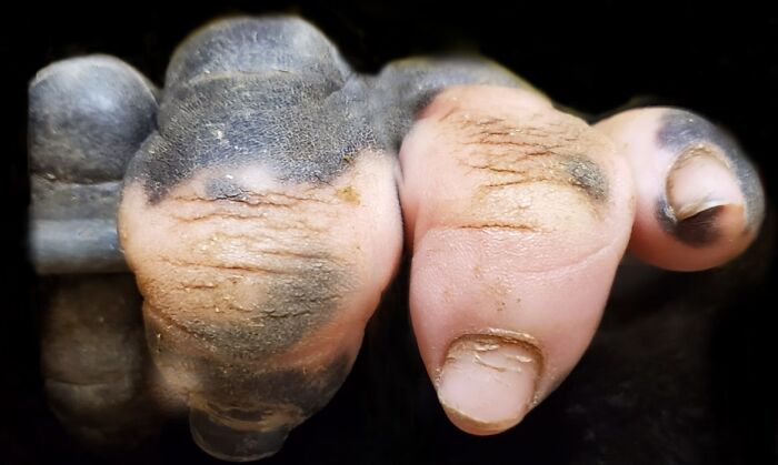  Los dedos de un gorila con vitiligo