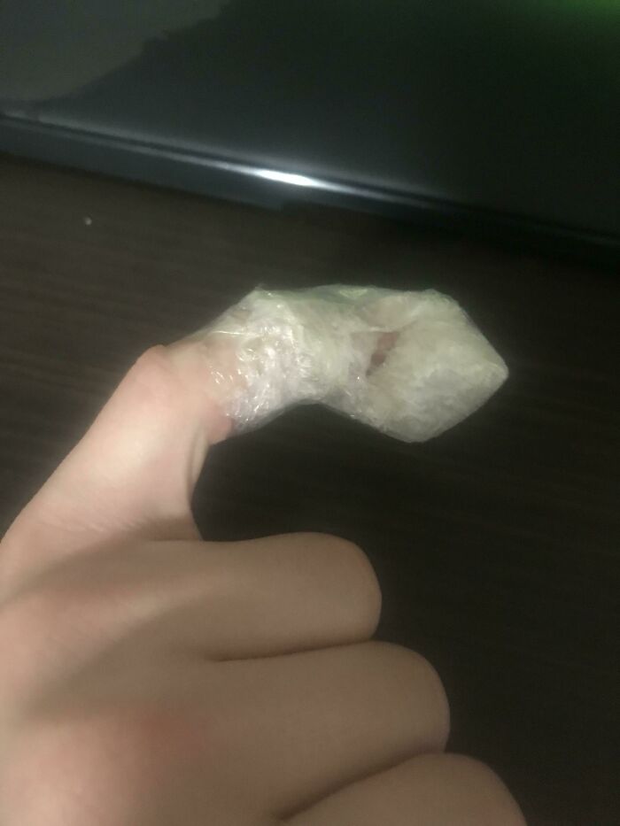 Burnt My Finger On The Grill At Work, So I Saran Wrapped An Ice Cube And Taped It To My Finger