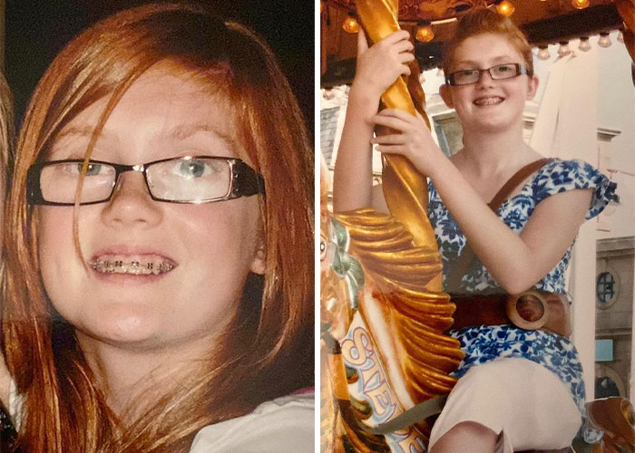 Woman Who Was “Spat At” And “Burned” At School For Having Ginger Hair Grows Up To Be Crowned Miss England
