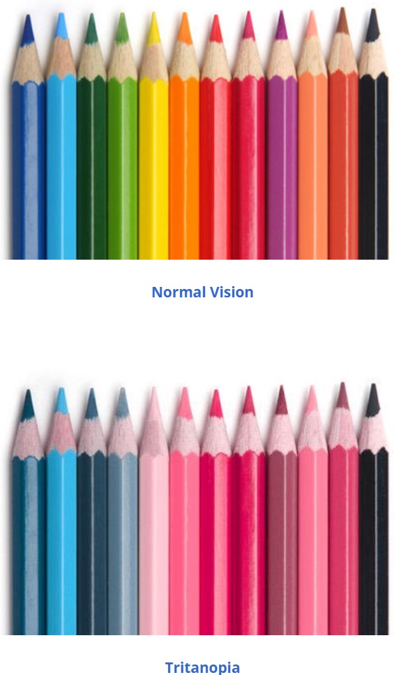 Tritanopia-634710a6a3823.jpg