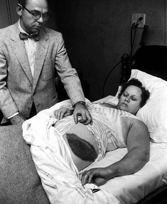 Ann Hodges, el único ser humano en la historia que fue golpeado por un meteorito. 1954