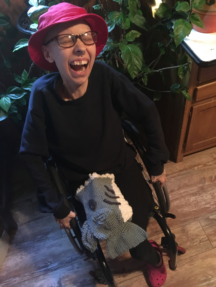I’m Three Weeks Out From My Amputation. Here’s My Halloween Costume. I Crocheted The Shark Myself
