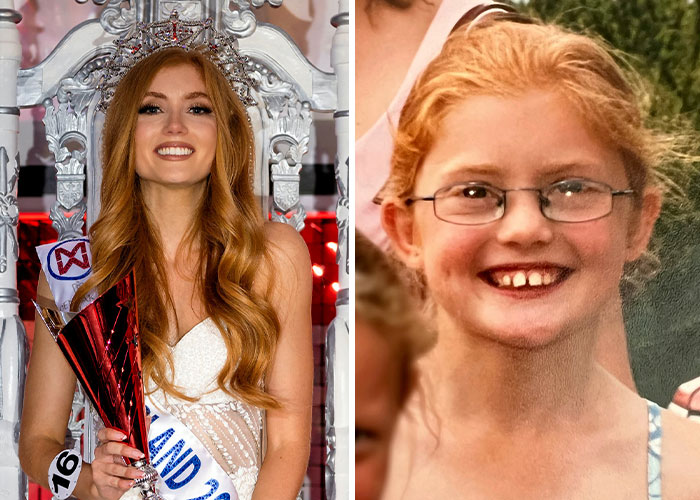 Woman Who Was “Spat At” And “Burned” At School For Having Ginger Hair Grows Up To Be Crowned Miss England