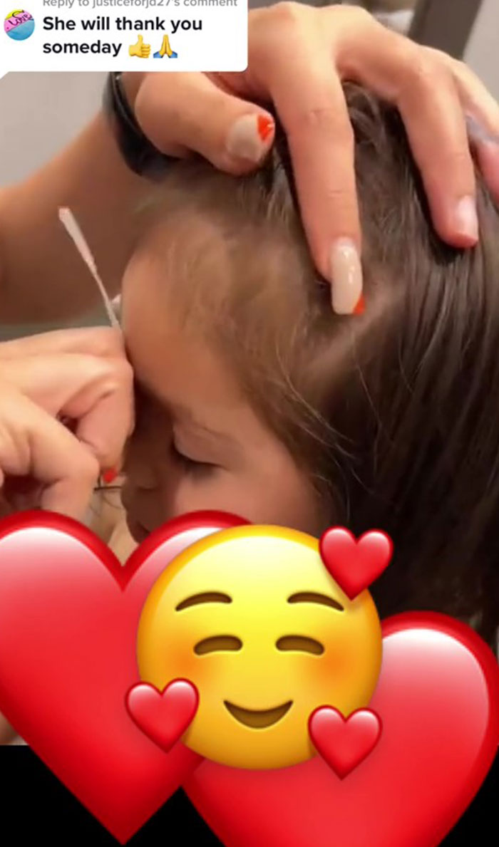 Mom Wants To Prevent Her 3 Y.O. From Being Bullied For Having A Unibrow, Waxes It Mom Wants To Prevent Her 3 Y.O. From Being Bullied For Having A Unibrow, Waxes It