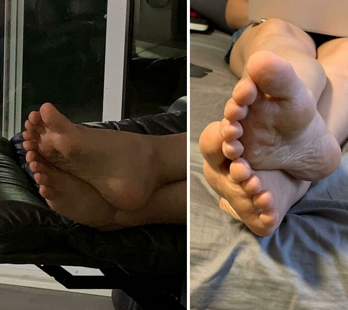 The Way My Fiancé’s Toes Line Up