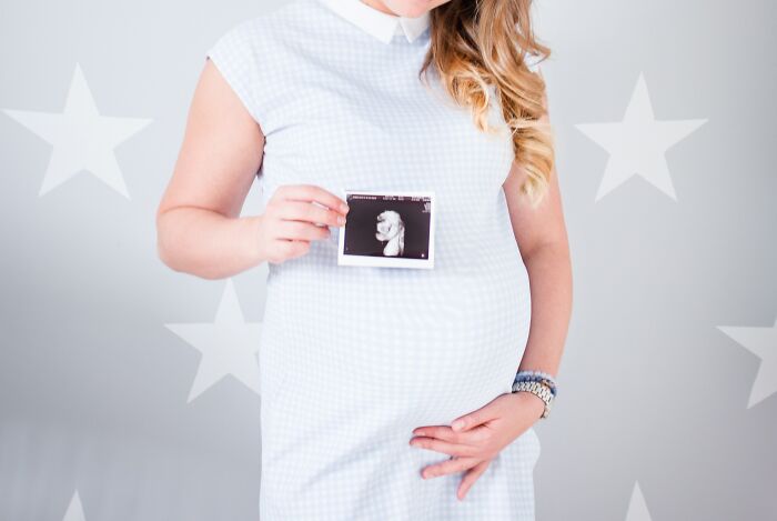Pregnant Woman Showing Her Pregnancy Picture 