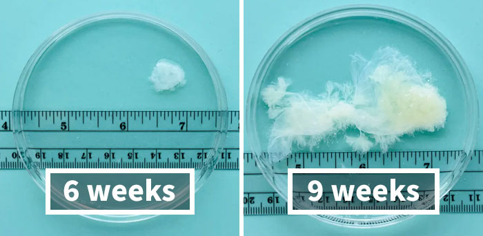 Some Anti-Abortion Folks Were Not Ready To See That A Pregnancy At 6 Weeks Doesn’t Have A Growing Embryo And Is Only Bodily Tissue