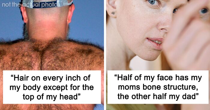 30 Times People Lost The Gene Lottery, According To This Viral Thread