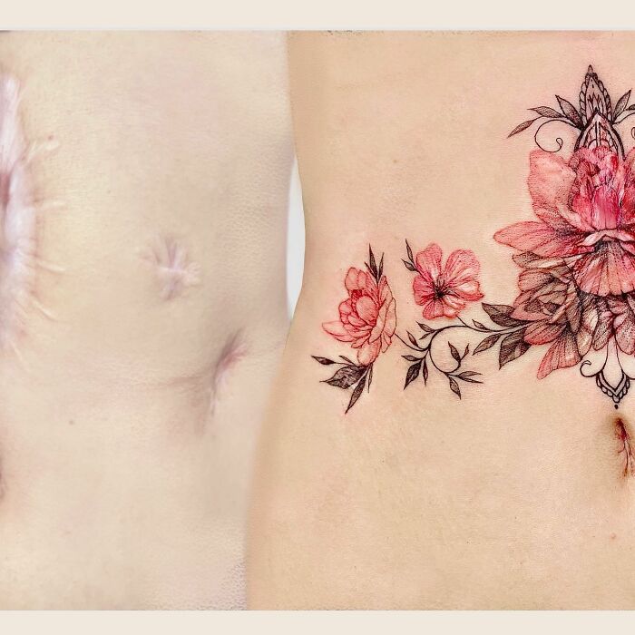 Scar-Coverup-Tattoos-Ngocliketattoo