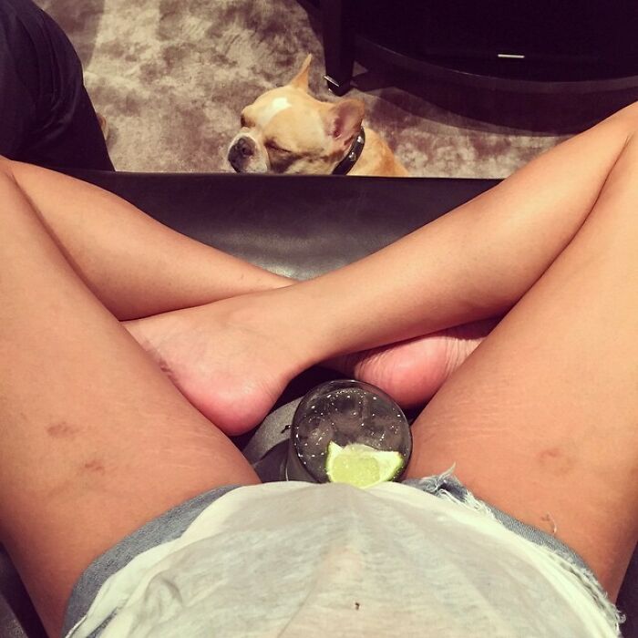 When Chrissy Teigen Shared This Photo Of Her Inner Thighs