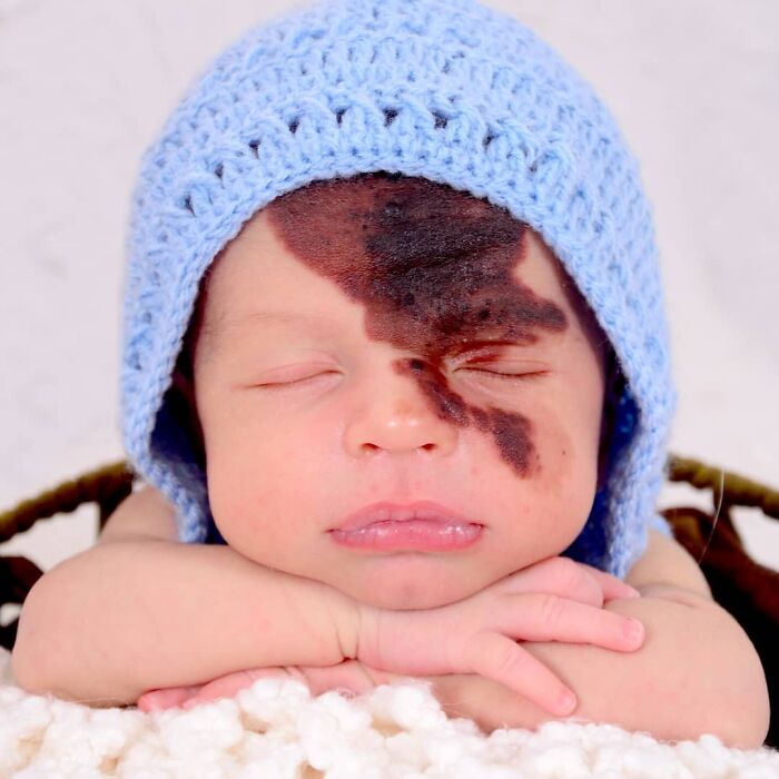 After realizing societal judgment about her son's distinctive appearance, this mother hired a makeup professional to replicate his birthmark on his face.