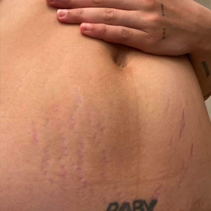 When Halsey Shared This Snap Of Their Postpartum Stretch Marks
